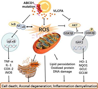 The Role of Oxidative Stress and Inflammation in X-Link Adrenoleukodystrophy